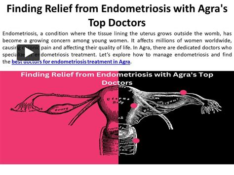 top doctors for endometriosis